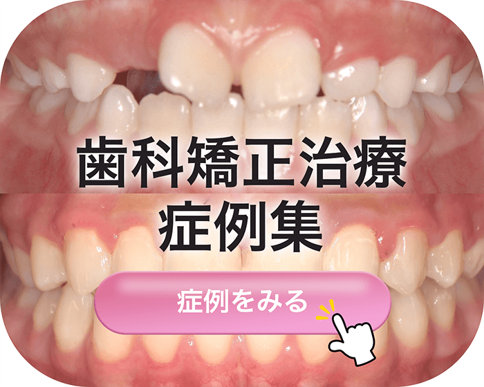 歯科矯正治療症例集
