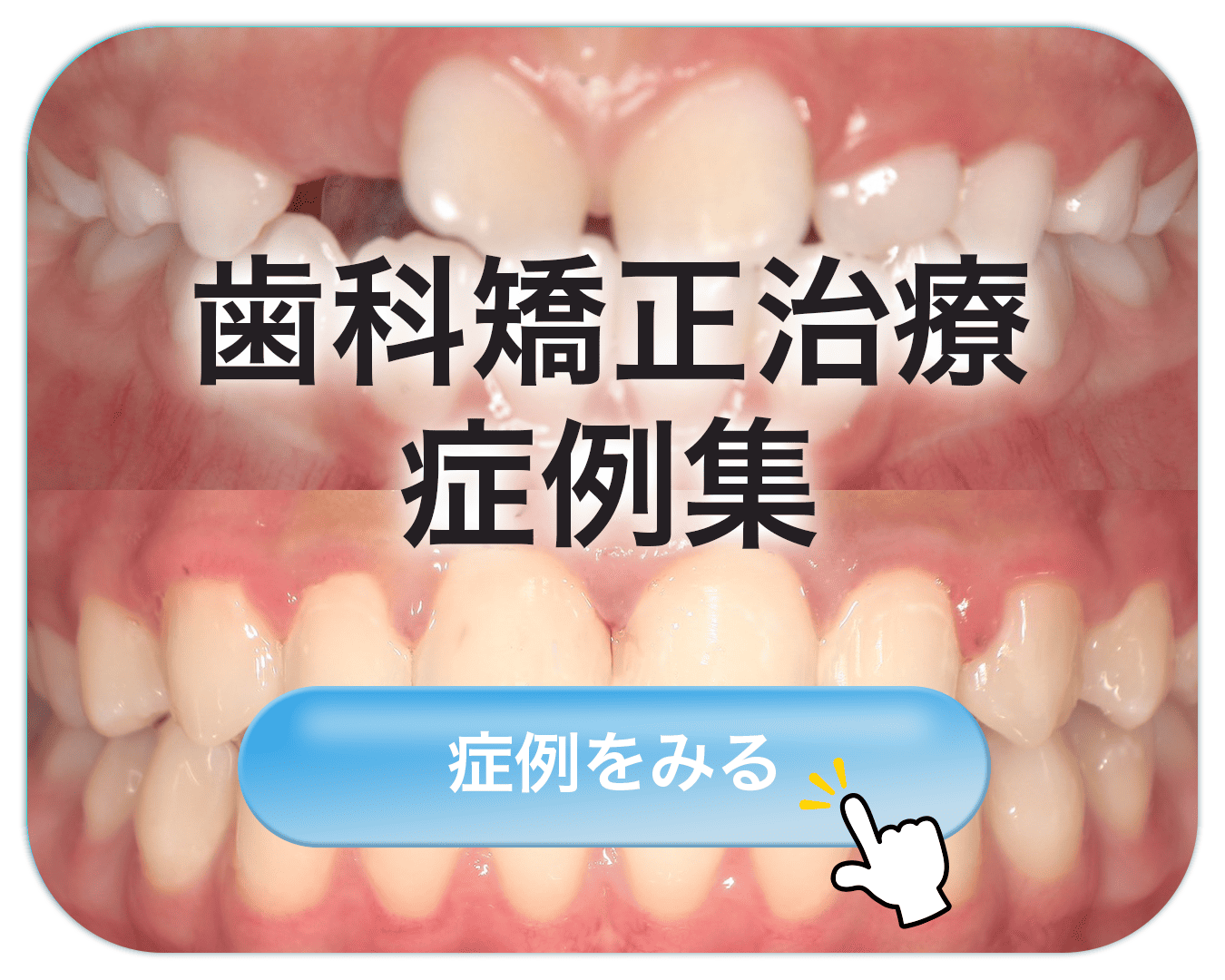 歯科矯正治療症例集