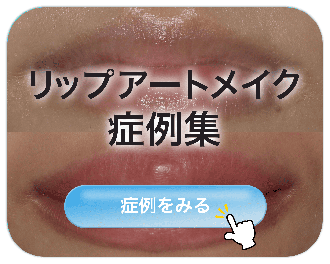 リップアートメイク歯科矯正治療症例集