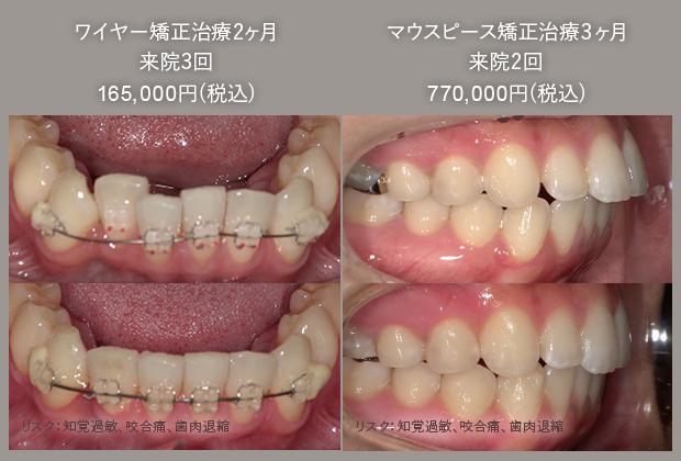 通いやすいから早く終わる