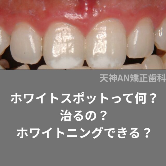 ホワイトスポットって治る？
